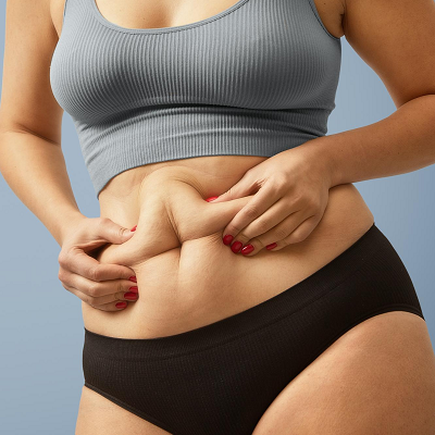 Abdominoplasty in Islamabad, Rawalpindi, and Pakistan