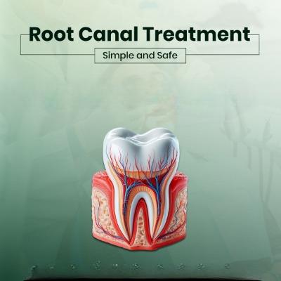 Root Canal Treatment in Islamabad, Pakistan